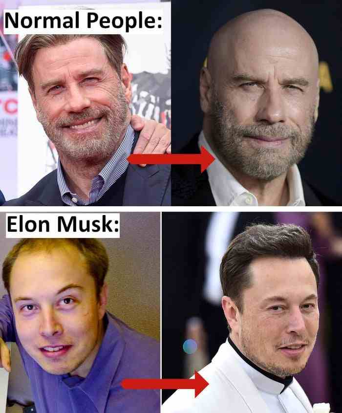 Normal People vs Elon Musk